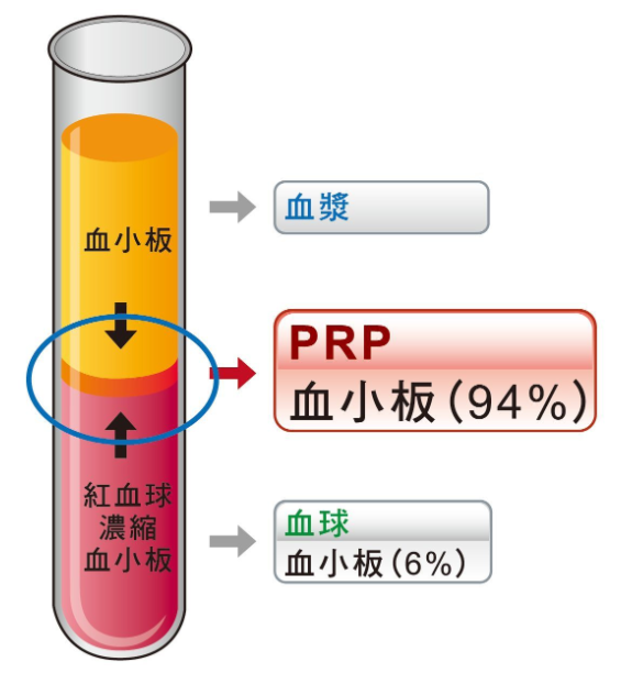 IVD分析